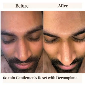 Before and after men's facial